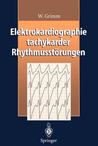 Kniha Elektrokardiographie Tachykarder Rhythmusstorungen W. Grimm