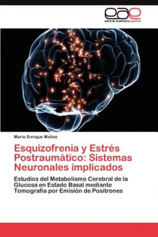 Könyv Esquizofrenia y Estres Postraumatico Mario Enrique Molina