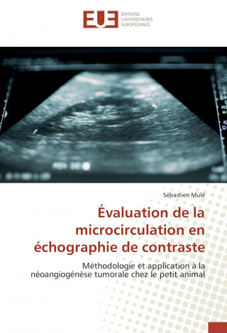 Carte Évaluation de la microcirculation en échographie de contraste Sébastien Mulé