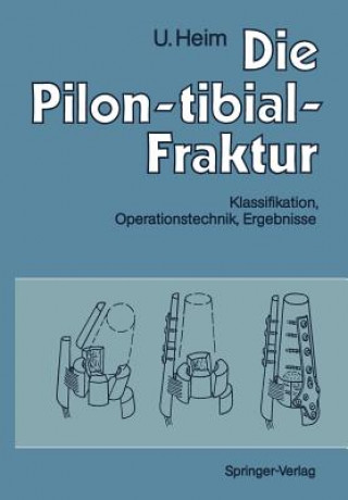 Kniha Die Pilon-tibial-Fraktur Urs Heim