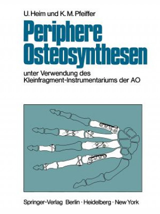 Kniha Periphere Osteosynthesen Urs Heim