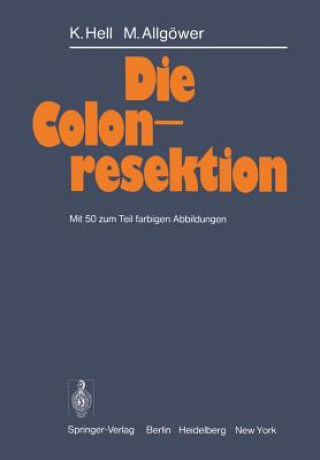 Kniha Die Colonresektion K. Hell