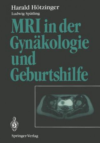 Könyv MRI in Der Gynakologie und Geburtshilfe Harald Hötzinger