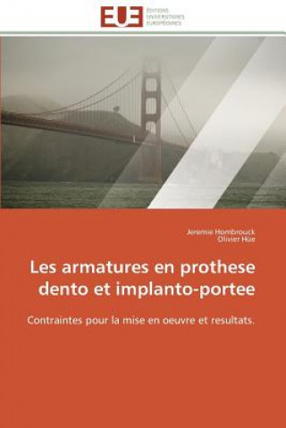 Buch Les Armatures En Prothese Dento Et Implanto-Portee Jeremie Hombrouck