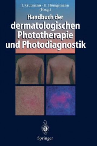 Carte Handbuch der Dermatologischen Phototherapie und Photodiagnostik Herbert Hönigsmann