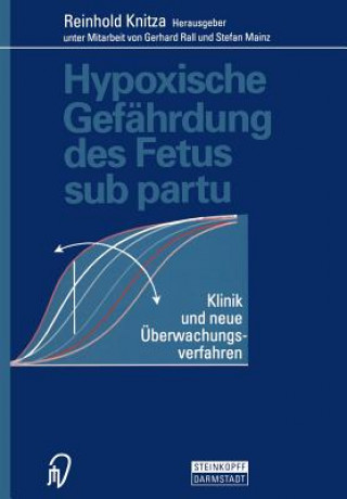 Carte Hypoxische Gefährdung des Fetus sub partu R. Knitza