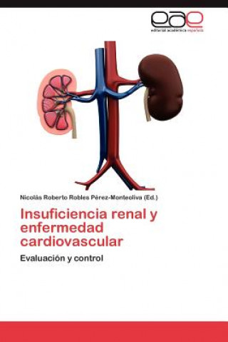 Kniha Insuficiencia renal y enfermedad cardiovascular Nicolás Roberto Robles Pérez-Monteoliva