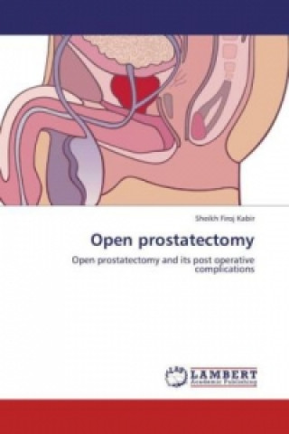 Книга Open prostatectomy Sheikh Firoj Kabir