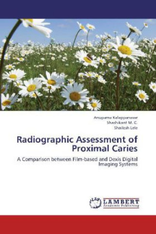 Carte Radiographic Assessment of Proximal Caries Anupama Kalappanavar