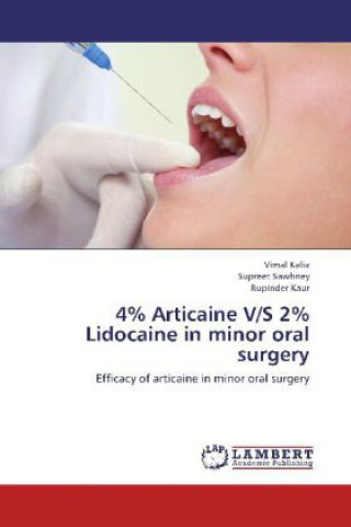 Knjiga 4% Articaine V/S 2% Lidocaine in minor oral surgery Vimal Kalia