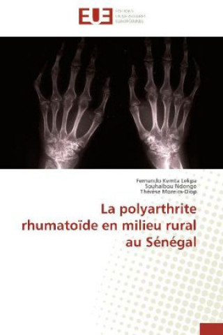 Knjiga La polyarthrite rhumatoïde en milieu rural au Sénégal Fernando Kemta Lekpa