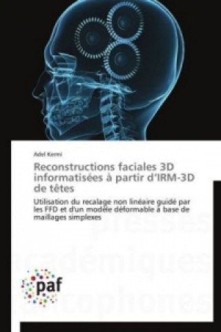 Book Reconstructions faciales 3D informatisées à partir d IRM-3D de têtes Adel Kermi