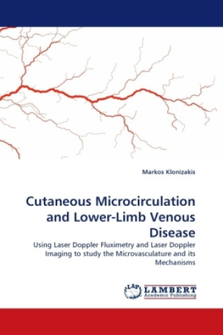 Carte Cutaneous Microcirculation and Lower-Limb Venous Disease Markos Klonizakis
