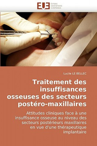 Buch Traitement Des Insuffisances Osseuses Des Secteurs Postero-Maxillaires Lucile Le Bellec