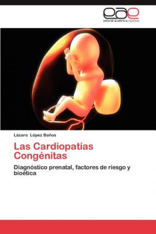 Carte Cardiopatias Congenitas Lopez Banos Lazaro