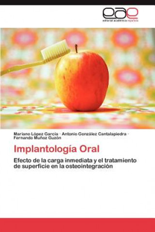 Könyv Implantologia Oral Mariano López García
