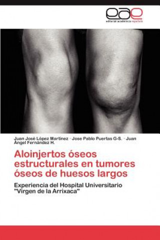 Книга Aloinjertos oseos estructurales en tumores oseos de huesos largos Juan José López Martínez