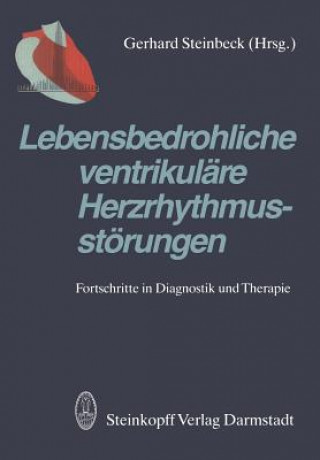 Kniha Lebensbedrohliche ventrikuläre Herzrhythmusstörungen G. Steinbeck