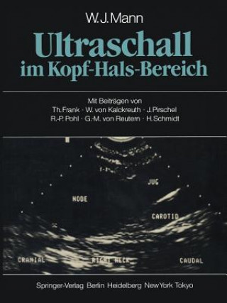 Книга Ultraschall im Kopf-Hals-Bereich W. J. Mann