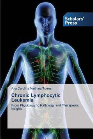 Könyv Chronic Lymphocytic Leukemia Ana Carolina Martinez-Torres