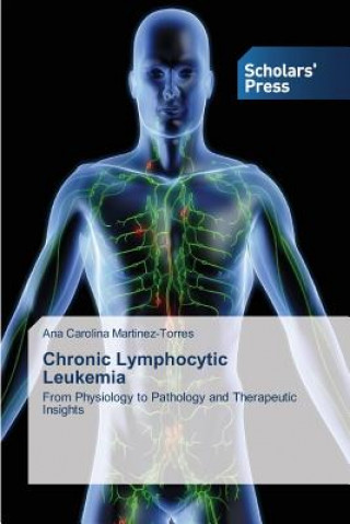 Libro Chronic Lymphocytic Leukemia Ana Carolina Martinez-Torres