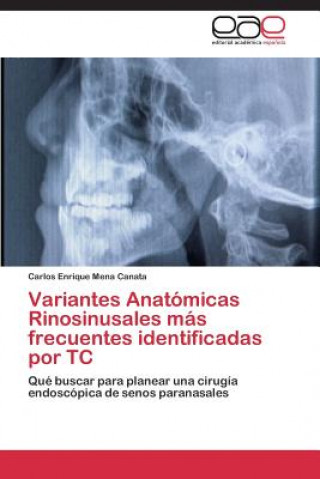 Книга Variantes Anatomicas Rinosinusales mas frecuentes identificadas por TC Carlos Enrique Mena Canata