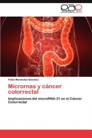 Книга Micrornas y Cancer Colorrectal Pablo Menéndez Sánchez