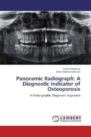 Kniha Panoramic Radiograph: A Diagnostic Indicator of Osteoporosis Shefali Waghray