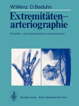 Kniha Extremitatenarteriographie W. Wenz
