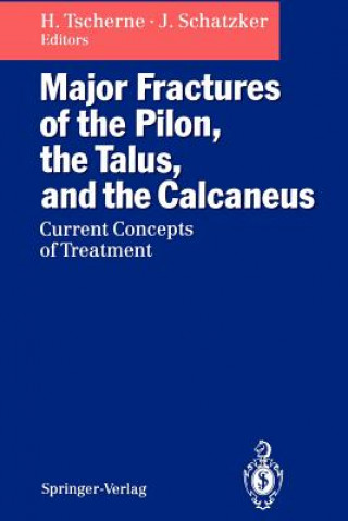 Könyv Major Fractures of the Pilon, the Talus, and the Calcaneus Joseph Schatzker