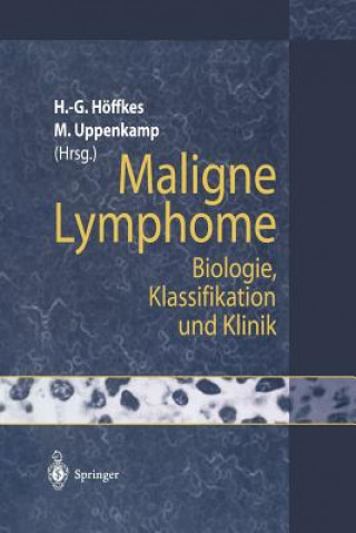 Knjiga Maligne Lymphome Heinz-Gert Höffkes