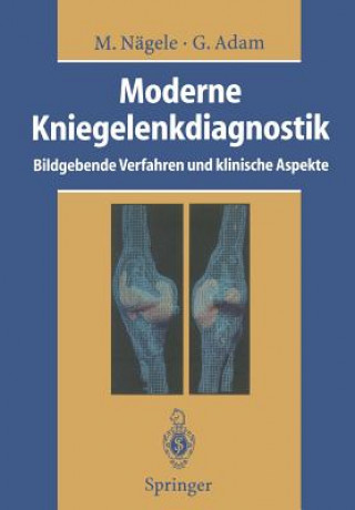 Book Moderne Kniegelenkdiagnostik Matthias Nägele
