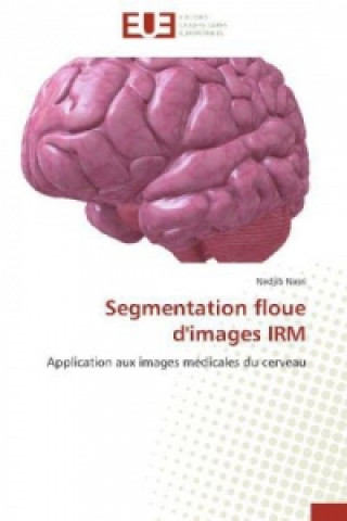 Carte Segmentation floue d'images IRM Nadjib Nasri