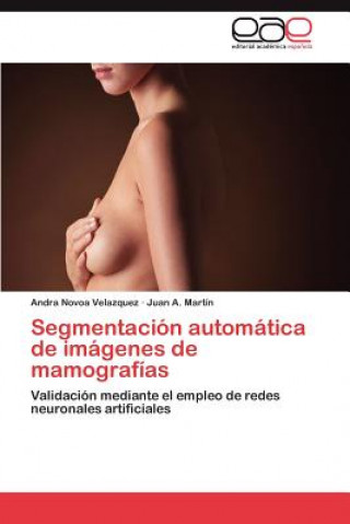 Könyv Segmentacion automatica de imagenes de mamografias Andra Novoa Velazquez