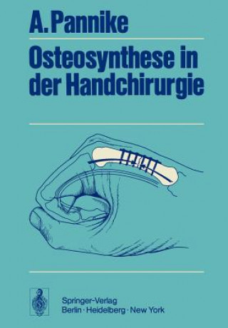 Kniha Osteosynthese in der Handchirurgie A. Pannike