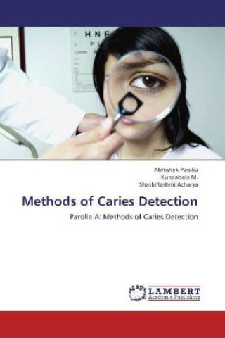 Book Methods of Caries Detection Abhishek Parolia