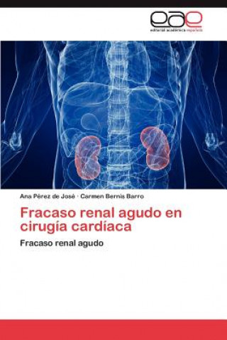 Carte Fracaso Renal Agudo En Cirugia Cardiaca Ana Pérez de José