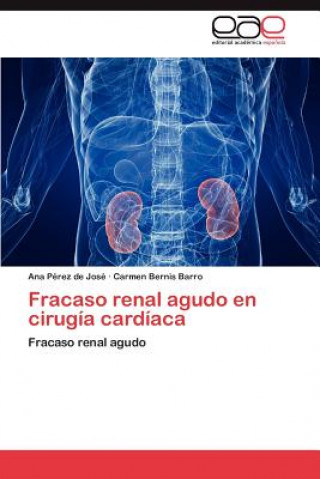 Książka Fracaso Renal Agudo En Cirugia Cardiaca Ana Pérez de José