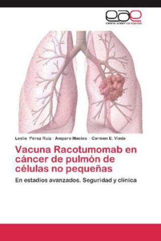 Libro Vacuna Racotumomab en cáncer de pulmón de células no pequeñas Leslie Pérez Ruiz