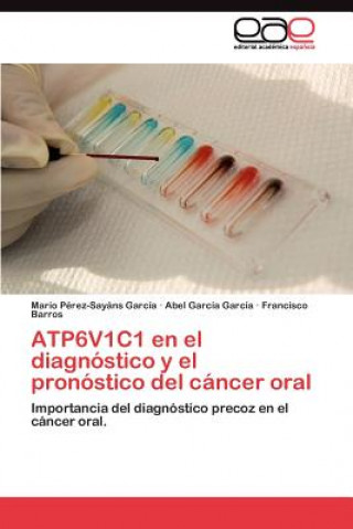 Книга ATP6V1C1 en el diagnostico y el pronostico del cancer oral Mario Pérez-Sayáns García