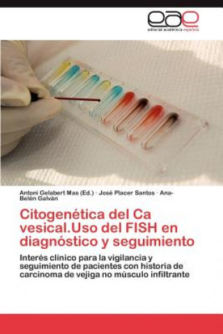 Carte Citogenetica del CA Vesical.USO del Fish En Diagnostico y Seguimiento José Placer Santos