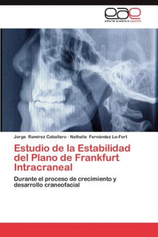 Książka Estudio de la Estabilidad del Plano de Frankfurt Intracraneal Jorge Ramirez Caballero