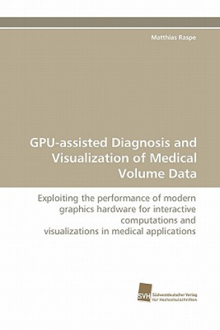 Könyv GPU-assisted Diagnosis and Visualization of Medical Volume Data Matthias Raspe