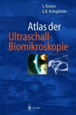 Kniha Atlas der Ultraschall-Biomikroskopie Sigrid Roters