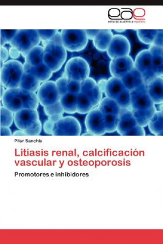 Carte Litiasis renal, calcificacion vascular y osteoporosis Pilar Sanchis
