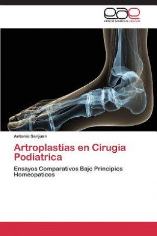 Carte Artroplastias en Cirugia Podiatrica Antonio Sanjuan