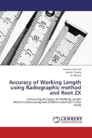 Kniha Accuracy of Working Length using Radiographic method and Root ZX Ashwini Santosh