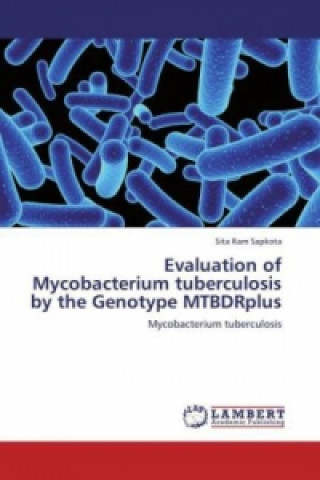 Kniha Evaluation of Mycobacterium tuberculosis by the Genotype MTBDRplus Sita Ram Sapkota