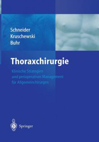 Könyv Thoraxchirurgie P. Schneider