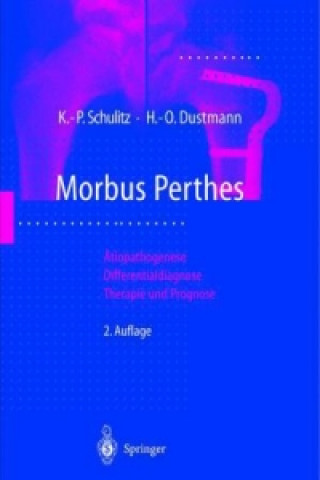 Könyv Morbus Perthes Klaus-Peter Schulitz
